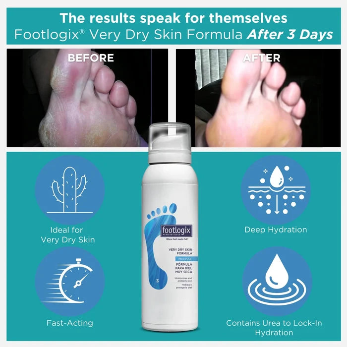 Footlogix Very Dry Skin Formula Mousse, 300 ml Footlogix